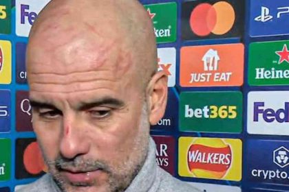 Guardiola explica por qué apareció con heridas en la cara tras el partido City vs Feyenoord