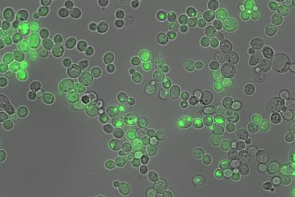 Una IA permite traducir el lenguaje de las proteínas vinculadas con el alzhéimer
